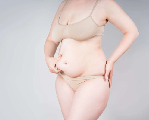 Abbildung einer Frau mit einem Hängebauch nach der Schwangerschaft