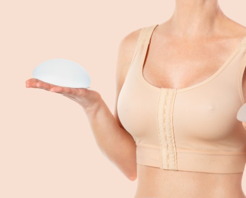 Eine Frau hält zwei Implantate in der Hand (Symbolbild für unterschiedlich große Brüste)